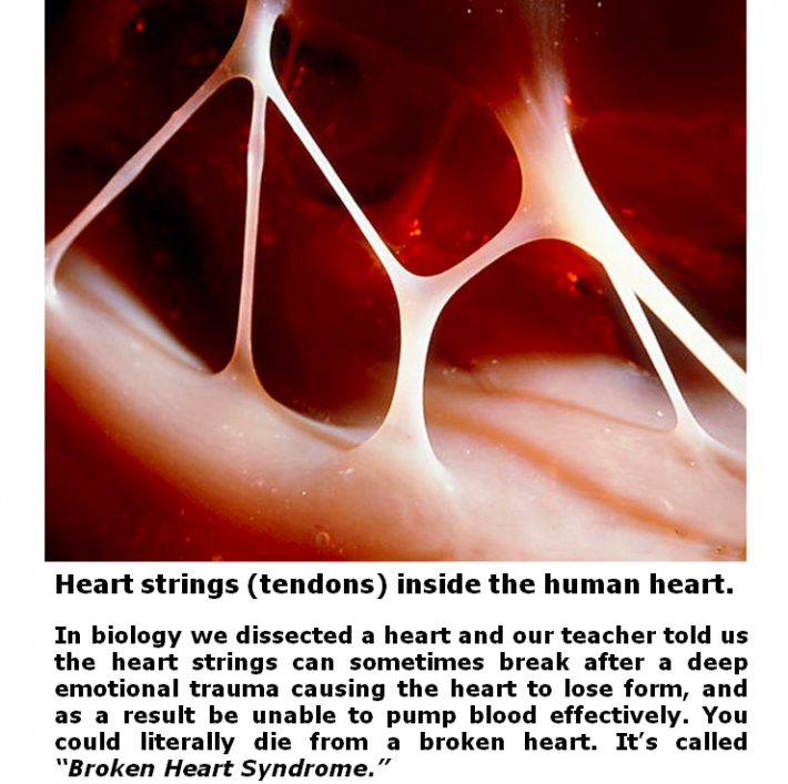 A Broken Heart Can Be Heartbreaking Indeed 1 broken heart syndrome tendons biology